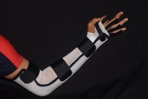 Burmec Bursa El Cerrahisi Microcerrahi BİLEK AĞRISI VE YARALANMALARI